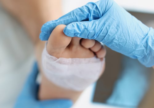 The Importance of Wound Care in Home Care Agencies